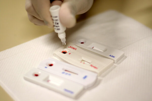 Como o contágio de ISTs vai além da epidemia 